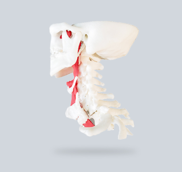 3Dプリント医療領域における応用-3 Dプリント気管モデル頚椎手術シミュレーション