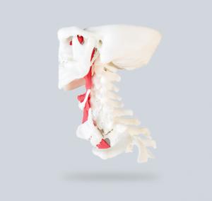 3Dプリント医療領域における応用-3 Dプリント気管モデル頚椎手術シミュレーション